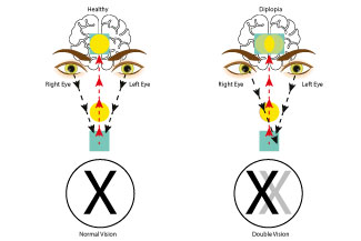 doublevision thumbnail.jpg